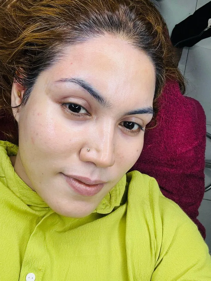 Santorini Glow Therapy result